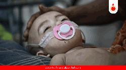 6 more die with measles symptoms in 24hrs