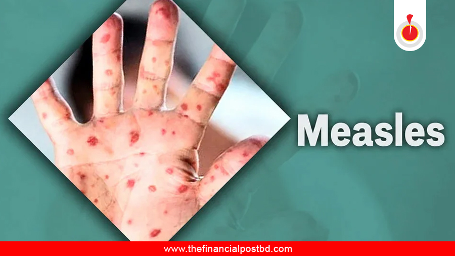 Measles-like symptoms claim 5 more lives