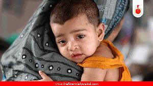 Measles symptoms claim 8 more lives, 1,232 hospitalised