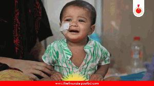 4 more die with measles and symptoms in 24 hours